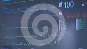 Heart monitor with ECG lines on the background of patient