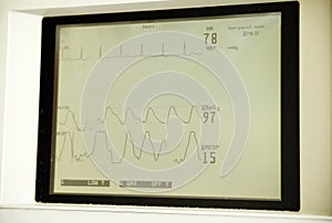 Heart monitor screen