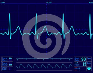 Heart monitor screen photo