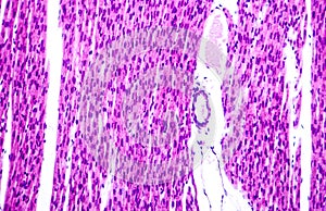 Heart muscle, light micrograph