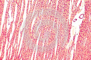 Heart muscle, light micrograph photo