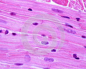 Heart. Myocardium. Striated muscla fibers