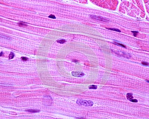 Heart. Myocardium. Striated muscla fibers photo