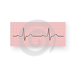 Heart Rate or a Heartbeat on a plotting paper. Cardiogram of the heart on a graph paper. Cardiogram of a healthy heart. Vector ill