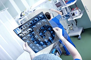 Heart scan (CT scan of the chest) in the hands of a doctor