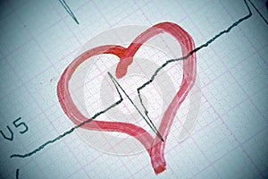 Heart shape on electrocardiogram.