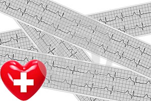 Heart, stethoscope on cardiogram report of cardiology patient. C