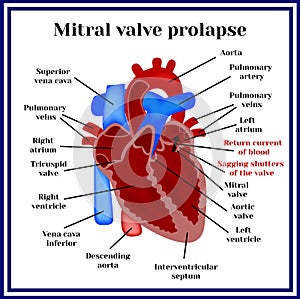 Corazón estructura. válvula ruptura. cardíaco patología 