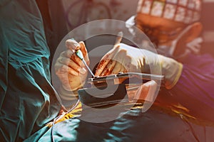 Heart surgery during open-heart surgery in operating room