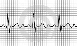 heartbeat icon. ECG Pathology Trace