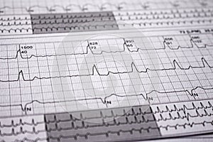 Heartbeat represented on paper. Cardiac arrhythmias. Selective focus on some beats. Atrial fibrillation Intraventricular