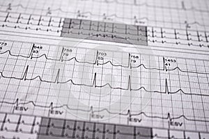 Heartbeat represented on paper. Cardiac arrhythmias. Selective focus on some beats. Free space to write