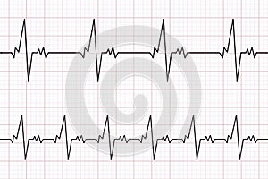 Heartbeats cardiogram. ECG heart line. Electrocardiogram paper background. Vector