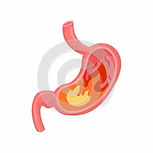 Heartburn in the stomach. Unhealthy stomach concept