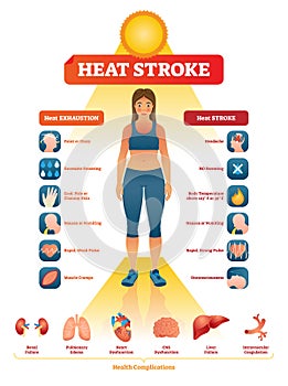Heat stroke vector illustration. Exhaustion symptoms labeled medical list. photo