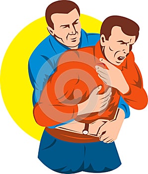 Heimlich maneuver on adult