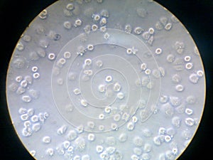 HeLa Cells photo