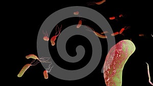 Helicobacter pylori animation microaerophilic bacterium which infects various areas of the stomach and duodenum.