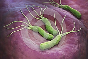 Helicobacter Pylori bacteria