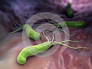Helicobacter Pylori photo