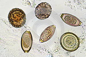 Helminth eggs