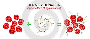 Hemagglutination, or haemagglutination. antibodies bind to antigens and form a clumping of erythrocytes photo