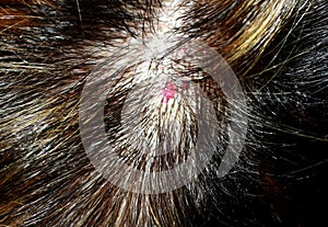 Hemangioma on the head. Red mole on the scalp. Mole in the hair. red birthmark. photo