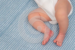 Hemangioma red birthmark on leg of newborn baby photo