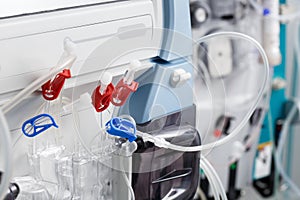 Hemodialysis bloodline tubes in dialysis machine