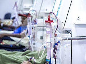 Hemodialysis in people on the equipment