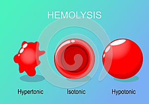 Hemolysis of Red blood cells photo