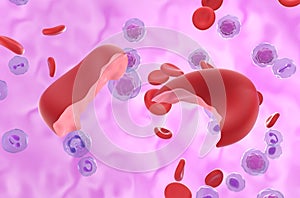 Hemolytic Anemia (HA) cells in the blood flow - closeup view 3d illustration