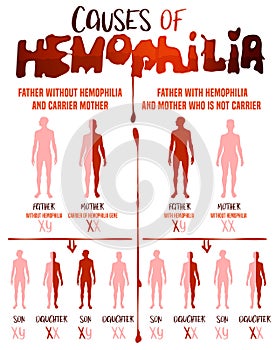 Hemophilia Causes Poster