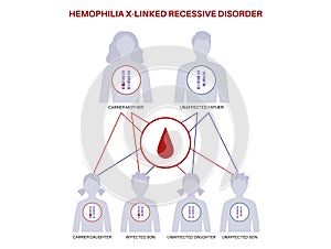 Hemophilia inheritance poster photo