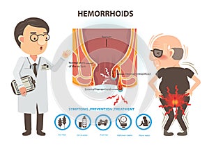 Hemorrhoids photo