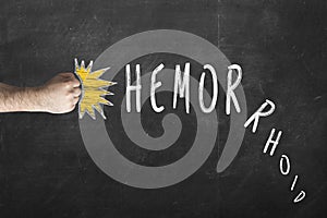 Hemorrhoids treatment concept