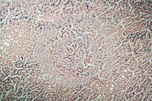Hemosiderosis liver under a microscope