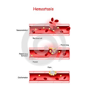 Hemostasis. Basic steps of wound healing process