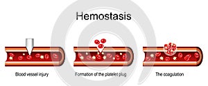 Hemostasis. Cross section of a Blood Vessel. wound healing