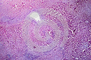 Hepatic congestion, light micrograph