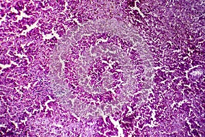 Hepatic congestion, light micrograph