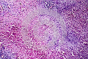 Hepatic congestion, light micrograph