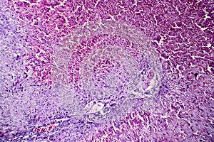 Hepatic congestion, light micrograph