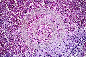 Hepatic congestion, light micrograph