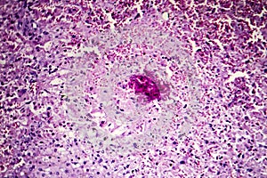 Hepatic congestion, light micrograph