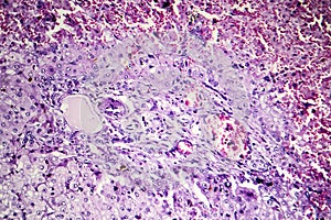 Hepatic congestion, light micrograph