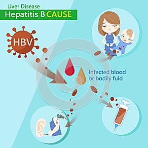 Hepatitis b cause