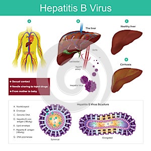 Hepatitis B virus. The virus is mainly transmitted by sexual con photo