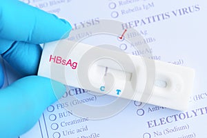 Hepatitis B virus negative test result