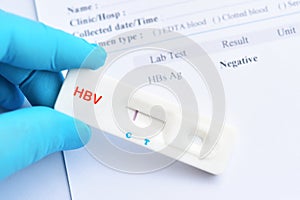 Hepatitis B virus negative test result
